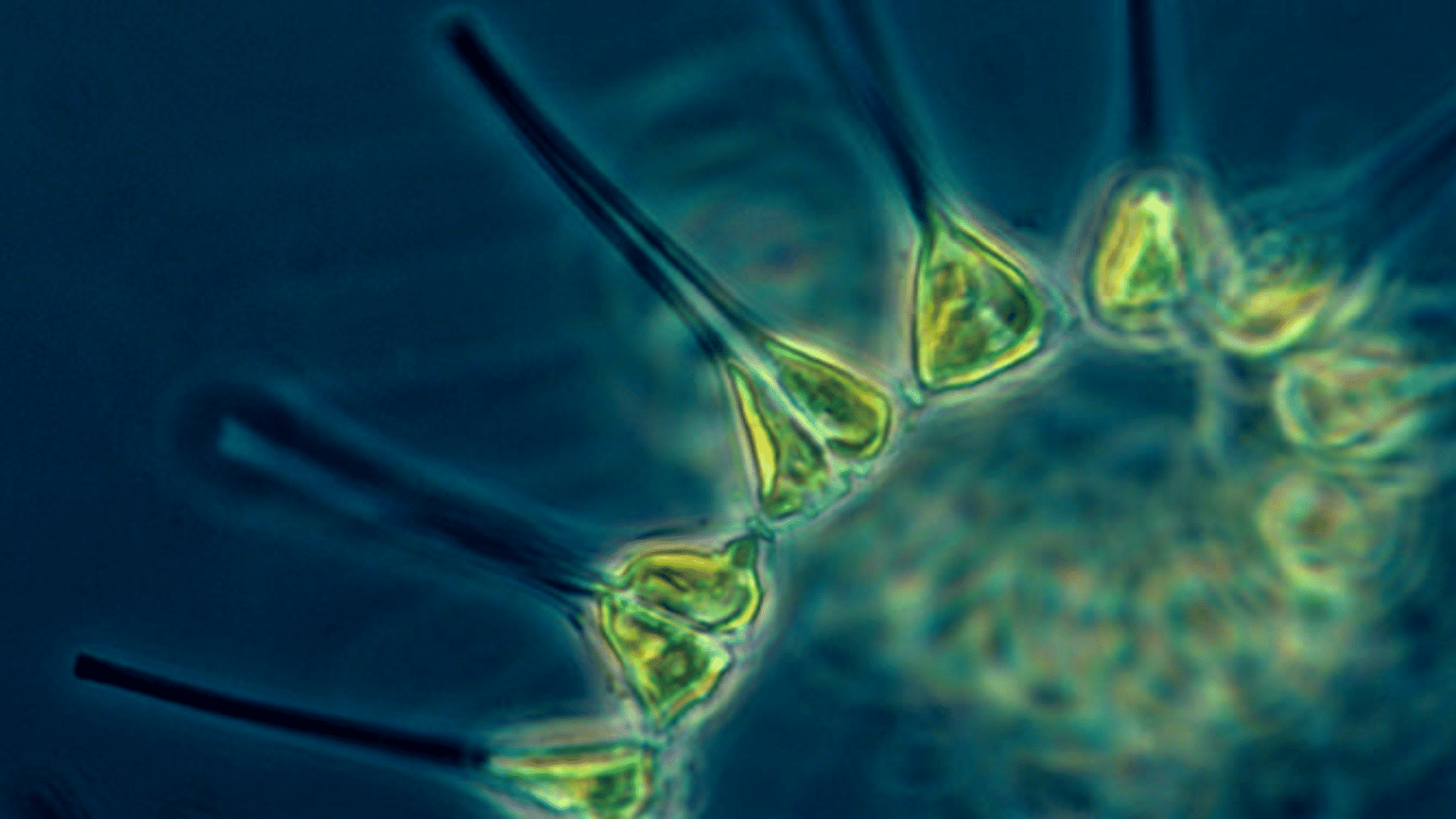 Microscopic phytoplankton chain glowing green against a dark blue water background.
